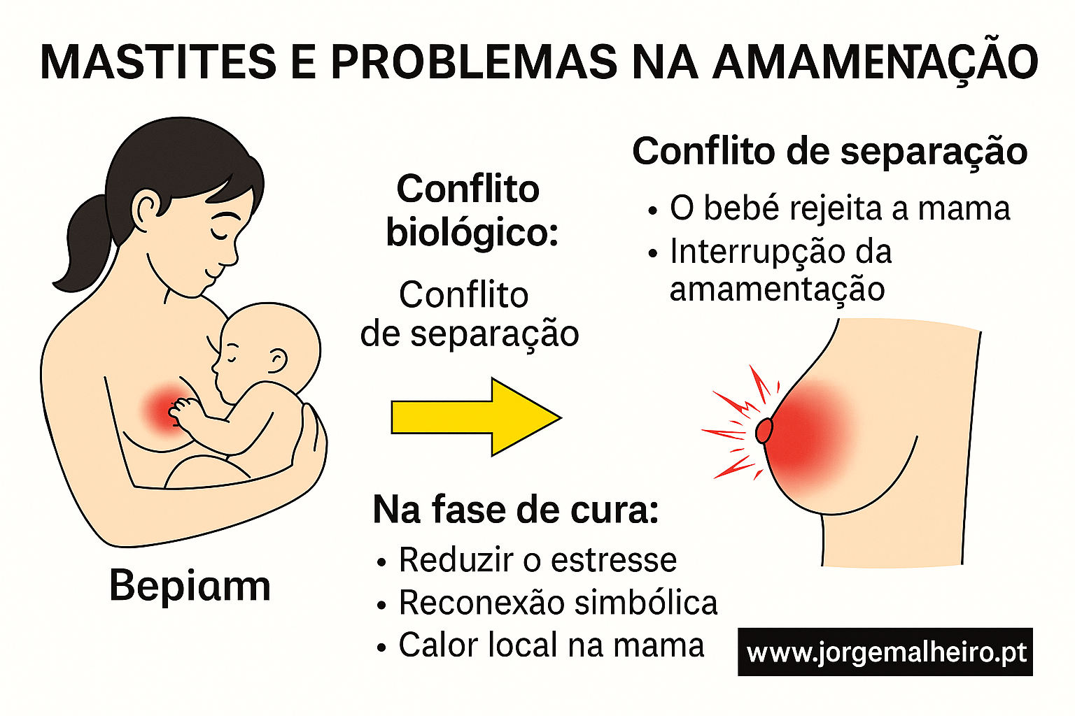 Mastites e problemas na amamentação (conflito de separação).